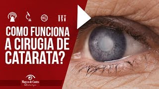 Como funciona a cirurgia de catarata  Dr Marcos de Castro Oftalmologia [upl. by Arline653]