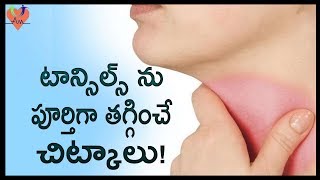 టాన్సిల్స్ ను పూర్తిగా తగ్గించే చిట్కాలు   Best Natural Home Remedies To Cure Tonsillitis  Arogya [upl. by Adriena340]