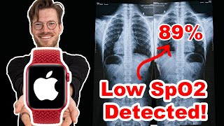 Apple Watch Scientific SpO2 Test Oxygen Saturation Review [upl. by Marlowe]