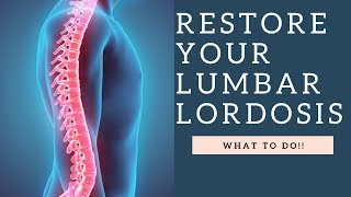 RESTORE Lumbar Lordosis amp The Curvature Of The Spine With These Exercises How To Demo [upl. by Norrehs]