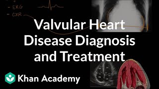 Valvular heart disease diagnosis and treatment  NCLEXRN  Khan Academy [upl. by Grochow]