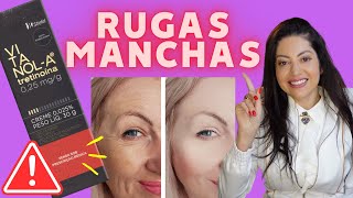 VitanolA Vitacid TretinoÃ­na Clareia Manchas Reduz Rugas e Combate Acne Como Usar [upl. by Eniaral]