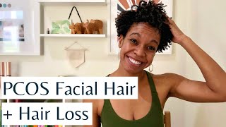 PCOS Facial Hair and Hair Loss  Causes Treatments amp Natural Ways to Reduce Hirsutism amp Hair Loss [upl. by Ahseiyk534]