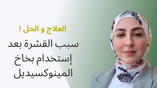 سبب ظهور القشرة بعد إستخدام المينوكيسيديل و طريقة العلاج [upl. by Losse269]