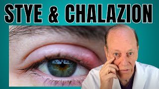 How a Plastic Surgeon Treats a Stye amp Chalazion [upl. by Maltzman616]