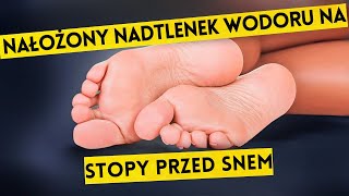 Oto Co Się Stało Już Po 2 Razach Nadtlenek Wodoru na Stopy [upl. by Gennaro]