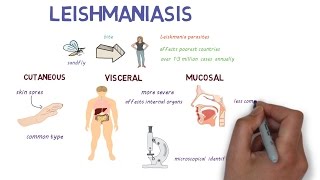 What is Leishmaniasis An introduction and overview [upl. by Lotson279]