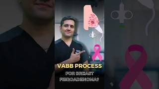 Process of Breast LumpFibroadenomas Removal [upl. by Eetnwahs]