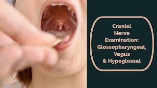 Cranial Nerve Examination CN 9 10 amp 12 glossopharyngeal vagus amp hypoglossal [upl. by Clementine]