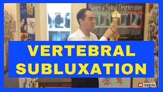 Vertebral Subluxation Spinal Misalignment Demo by Dr Walter Salubro Chiropractor in Vaughan [upl. by Aneehs]