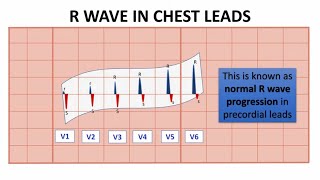 Normal R wave progression NORMAL R WAVE IN LIMB AND CHEST LEADS quotNORMAL ECG VALUESquot  NARCOSIS😴🤤 [upl. by Eniamert338]