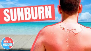 How to treat a Sunburn  Doctor Explains [upl. by Duffy]