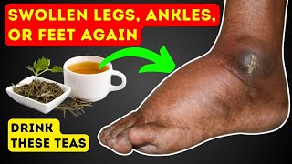 Drink These 4 Teas to Never Have Swollen Legs Ankles or Feet Again swelling legs viralvideo [upl. by Adnowal]