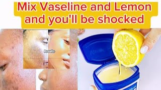 How To Apply Vaseline and Lemon on Face and Body Mix Vaseline with Lemon and you will be shocked [upl. by Mehta296]