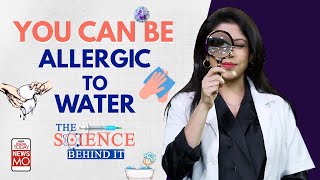 Can You Get Allergic to Water ll What Is The Science Behind Aquagenic Urticaria [upl. by Ecirtal]