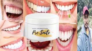 Jiore Pre Smile Teeth Whitening Powder  Honest Review [upl. by Ynetruoc683]