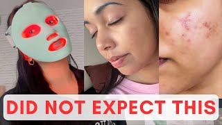 Non Sponsored LED mask review  before and after  QURE infrared light therapy ✨ [upl. by Leighton]