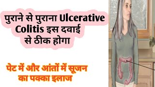 ulcerative colitis Treatment  Diet and yoga  Best Homeopathic medicine for U colitis  dr tarun [upl. by Sorips]