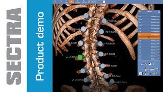 Sectra 3D Spine [upl. by Araiek118]