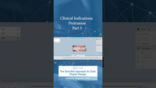 Clinical Indications Protrusion Part 5 [upl. by Htebsle]