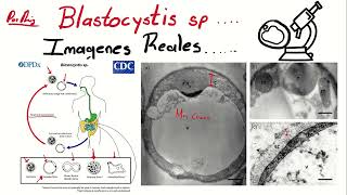 Blastocystis hominis al microscopio óptico [upl. by Alesandrini822]