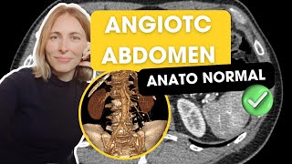 AngioTC de abdomen Anatomía normal y secretos para la mejor evaluación✅ [upl. by Luigino]