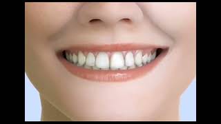 How to work teeth brackets teeth teethbraces teethbrackets teethtreatment dailyroutine songs [upl. by Vyse]