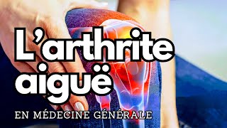 Larthrite aiguë en médecine générale [upl. by Akirahc]