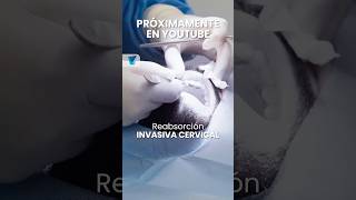 🦷 ¿Sabías que la reabsorción invasiva cervical puede afectar la salud de tu sonrisa🦷 dentista [upl. by Akiaki]