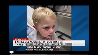 3YrOld Bit Unprovoked Parents Defend Dog [upl. by Westney]