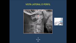 3 Región cervical de la columna vertebral su valoración en radiografías simples [upl. by Odlanra735]