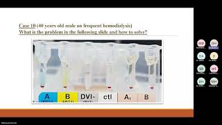 Cases StudyABO Discrepancy Part 2 Dr Mohamed Samir [upl. by Ahsilram]