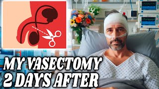 MY VASECTOMY SURGERY  2 DAYS AFTER [upl. by Sirromad84]