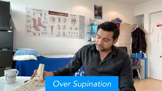 Over Supination and Under Pronation  Abid Hussain Podiatrist [upl. by Lipsey]