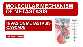 Molecular Basis of Metastasis  Invasion  Metastasis Cascade [upl. by Roxi]