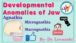 DEVELOPMENTAL ANOMALIES OF JAW  Agnathia  Micrognathia  Macrognathia  Part  1 [upl. by Seldon]