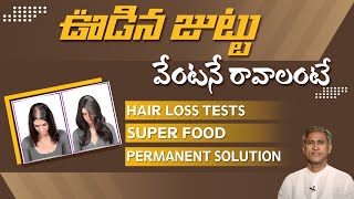 Solution For Hair Fall  Causes For Hair Loss  Manthena Official [upl. by Ariek]