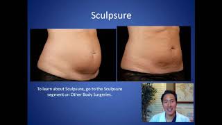 How do I Get Rid of Stubborn Fat  SculpSure and Liposuction Consultation  Dr Anthony Youn [upl. by Savinirs]