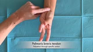 WRIST and HAND  PALPATION Palmaris brevis tendon [upl. by Chemarin]