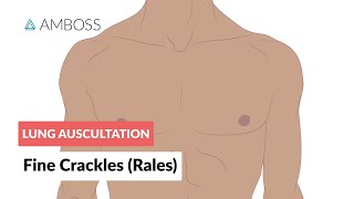 Fine Crackles Rales  Lung Auscultation  Episode 2 [upl. by Selym]