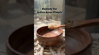 How to get rid of Acne  Acne treatment at home  pimples removal on face at home  short skincare [upl. by Jania274]