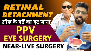 Retinal Detachment Treatment  आँख के उखड़े पर्दे का इलाज  PPV Surgery Pars Plana Vitrectomy [upl. by Douty]