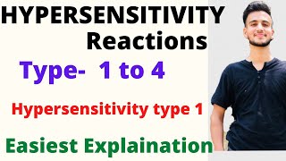 Hypersensitivity reactions  Hypersensitivity type 1 Hypersensitivity reactions type 1234 [upl. by Enaed]