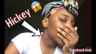 HICKEY PRANK on mom TRIES TO HIT ME Hilarious 😆 IamMyaa [upl. by Victory]