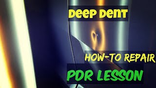 DEEP Dent Repair REAL world PDR [upl. by Walker]