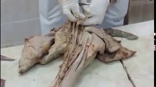 Mod 4  MS  Practical Anatomy  Dr Hazem Gamal  Upper Limb  Part 01 [upl. by Castle]