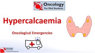 Hypercalcaemia of malignancy [upl. by Sheri]