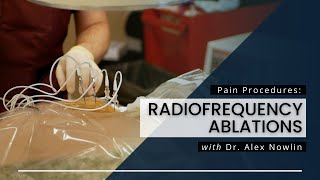 Radiofrequency Ablations What You Should Know [upl. by Keemahs]