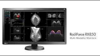 RX850 ProductDemo RSNA2020 [upl. by Gathard]