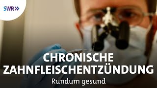 Volkskrankheit Parodontitis  Ursachen und Behandlungen  Rundum gesund [upl. by Azila]